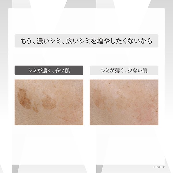 画像6: ワンバイコーセー メラノショット P 40ml【医薬部外品】 (6)